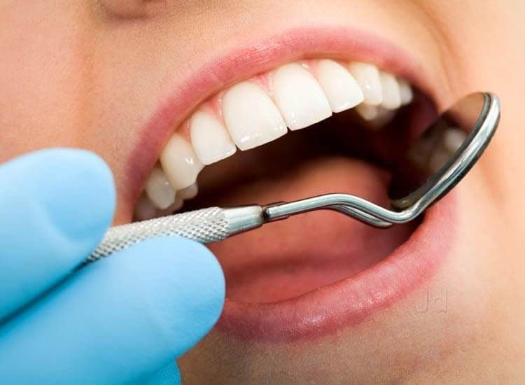 piaskowanie zębów, dentysta Poznań, stomatolog Poznań